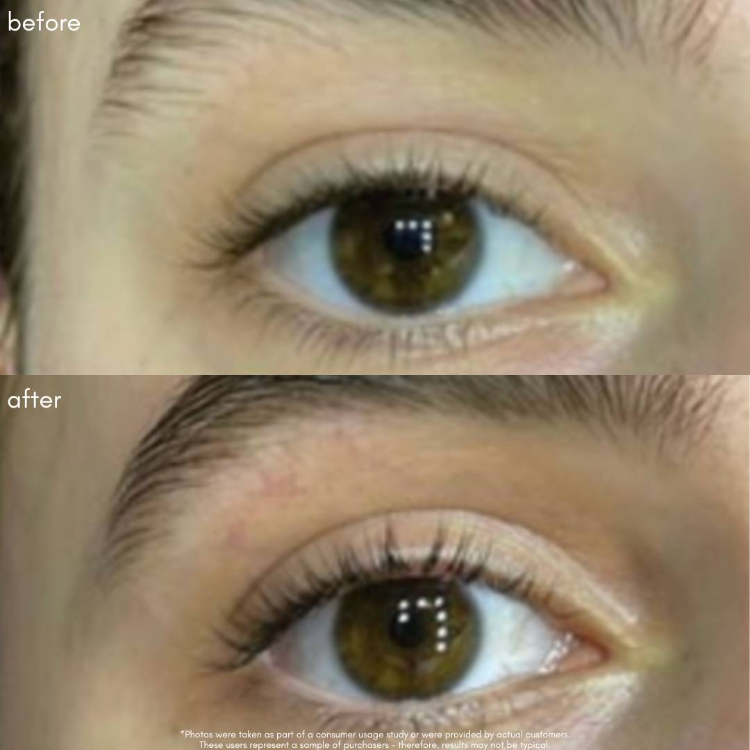 Power Fol Lash & Brow Before & After
