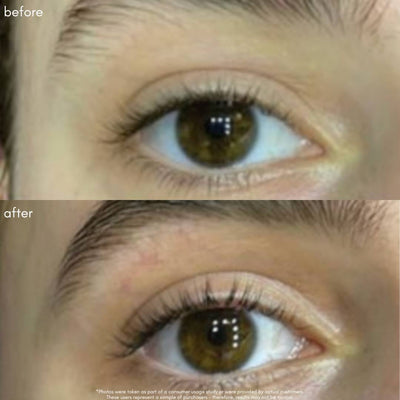 Power Fol Lash & Brow Before & After