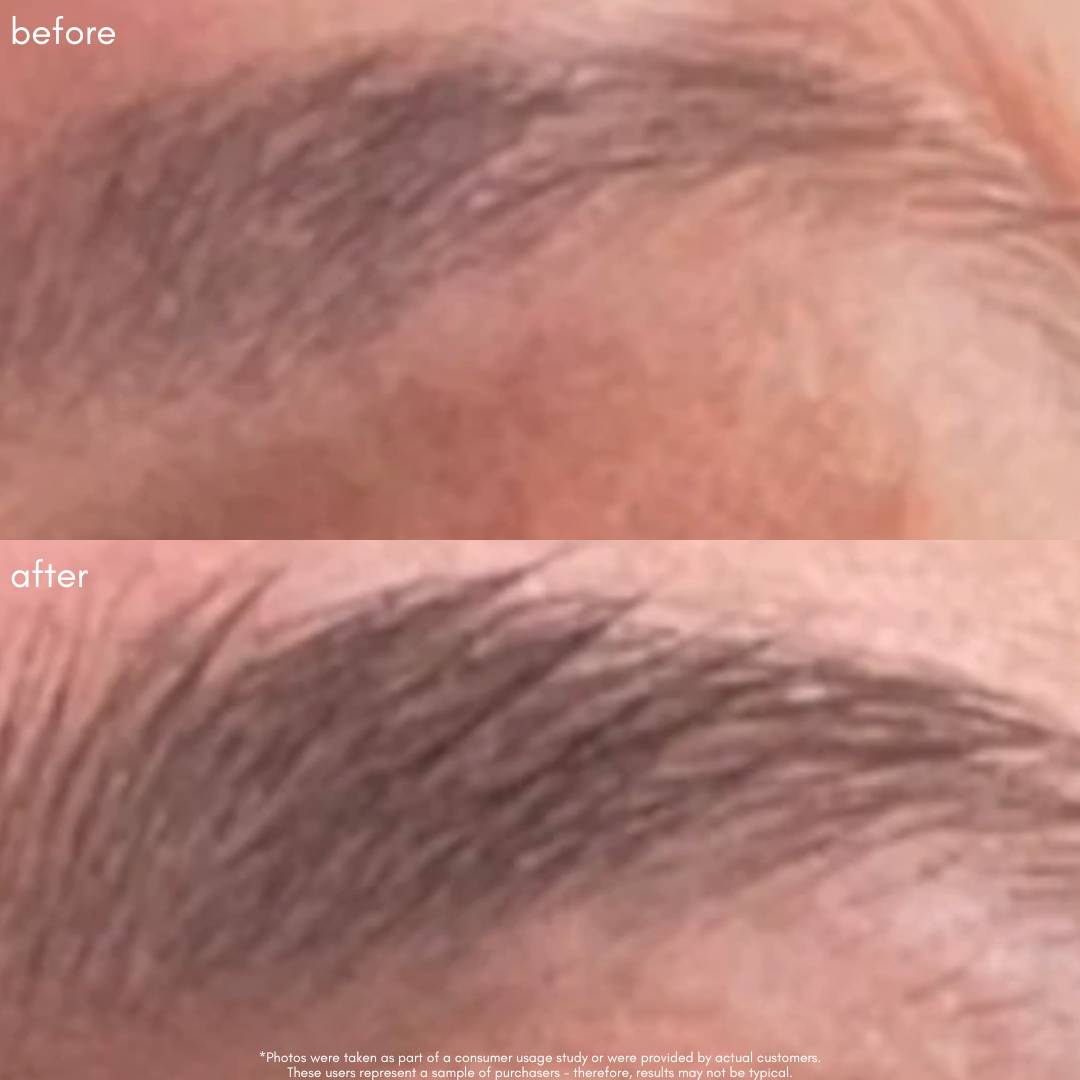 Power Fol Lash & Brow Before & After
