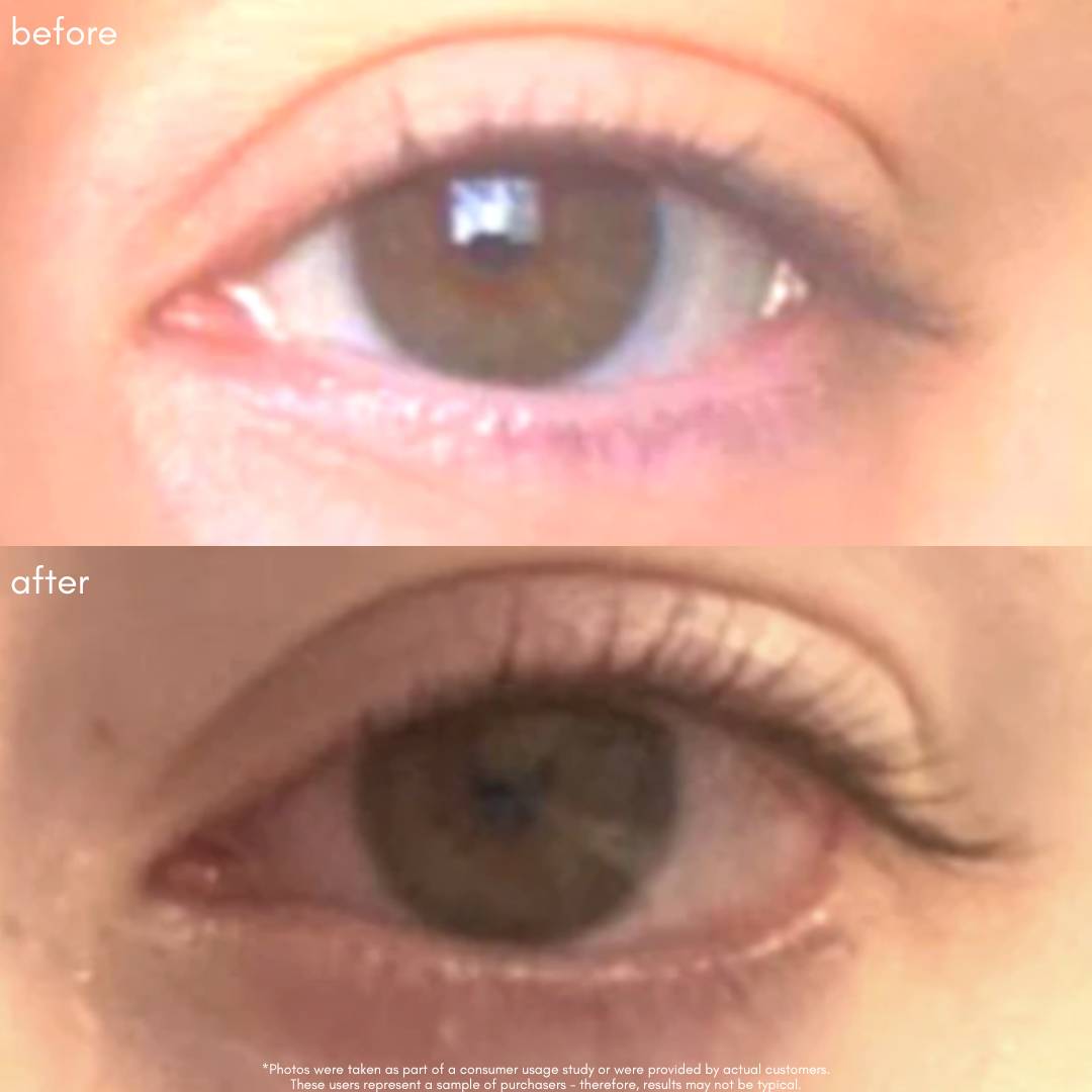 Power Fol Lash & Brow Before & After