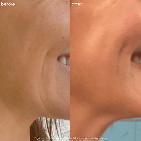 The Advanced Response Complex Face | Neck | Eye Bundle