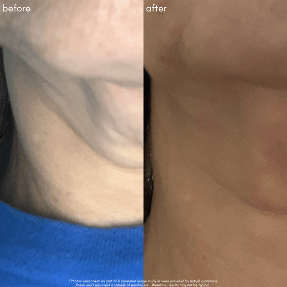 The Advanced Response Complex Face | Neck | Eye Bundle