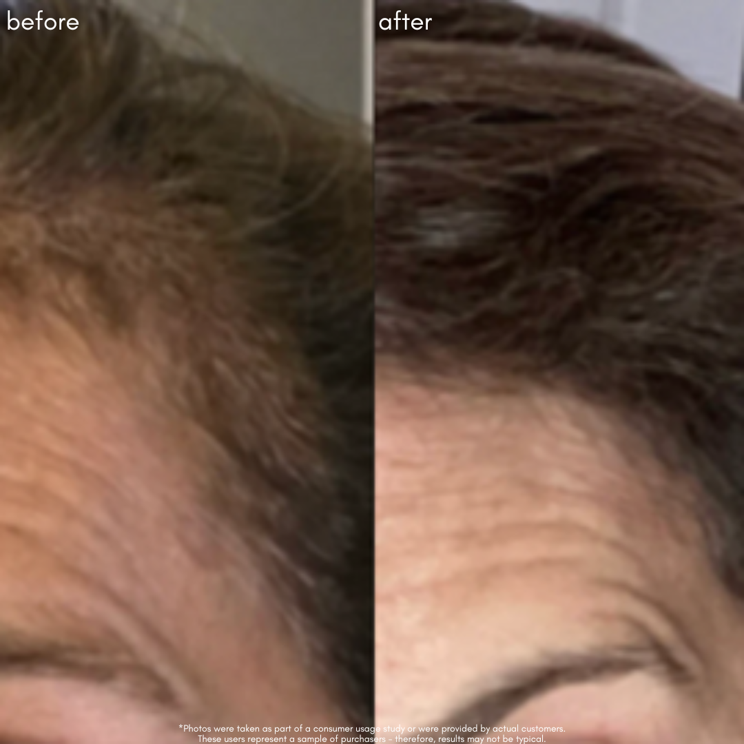 Power Fol - Advanced Multi-Correctional Scalp & Hair Treatment - Maya Chia Before + After