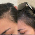 Power Fol - Advanced Multi-Correctional Scalp & Hair Treatment
