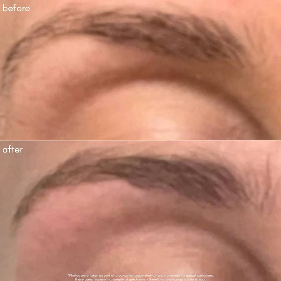 Power Fol - Multi - Correctional Eyelash & Eyebrow Serum - Maya Chia