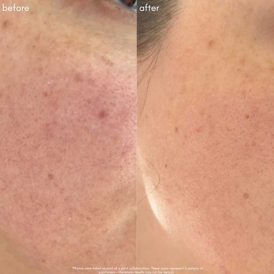 The Straight A - Advanced Gentle Retinol Serum - Maya Chia