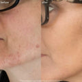 The Straight A - Advanced Gentle Retinol Serum - Maya Chia