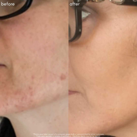 The Straight A - Advanced Gentle Retinol Serum - Maya Chia