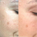 The Straight A - Advanced Gentle Retinol Serum - Maya Chia