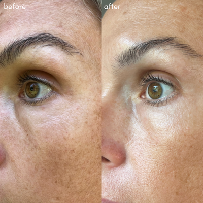 The Advanced Eye Response Complex - Maya Chia. Before + After