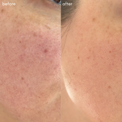 The Advanced Response Complex - Face & Neck Moisture Cream - Maya Chia Before + After
