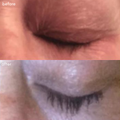 Power Fol Lash + Brow Before + After