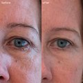 The Advanced Eye Response Complex - Maya Chia. Before + After