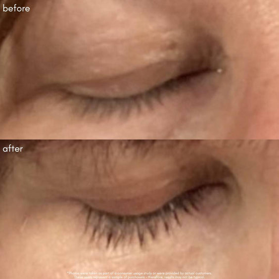 Power Fol Lash & Brow Before & After