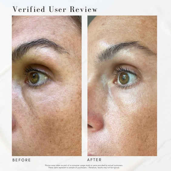 The Advanced Eye Response Complex