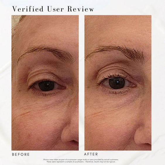 The Advanced Eye Response Complex