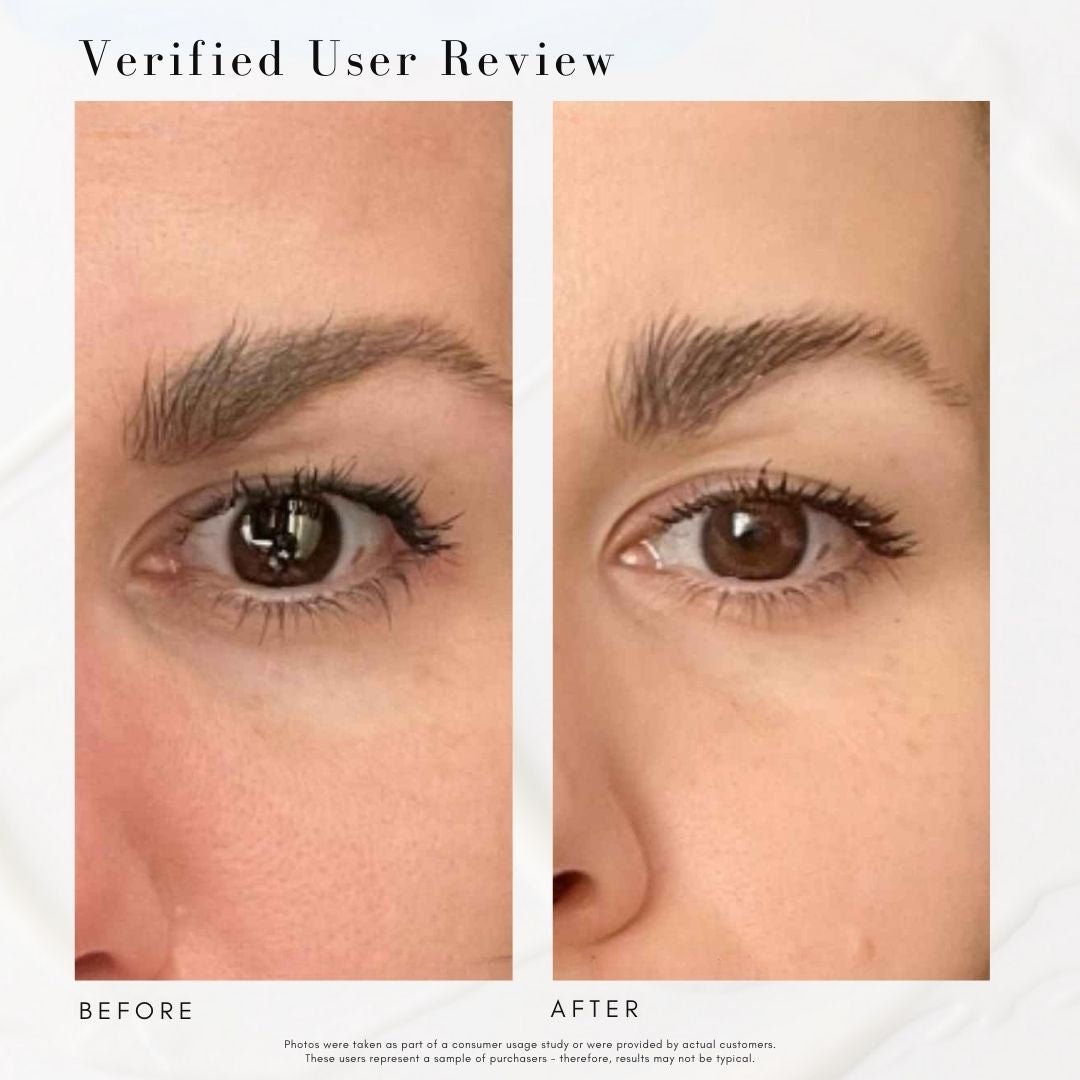 The Advanced Eye Response Complex