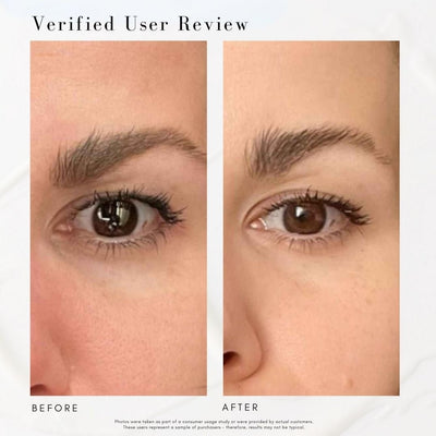 The Advanced Eye Response Complex