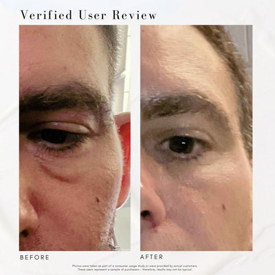 The Advanced Eye Response Complex