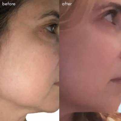 The Advanced Response Complex - Face & Neck Moisture Cream - Maya Chia Before + After