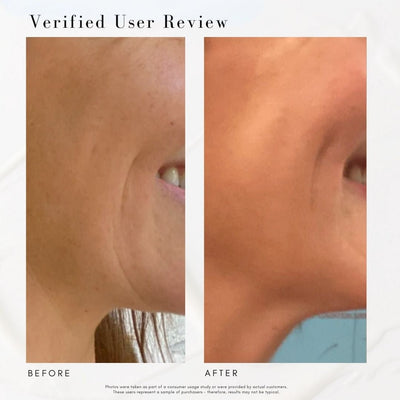 The Advanced Response Complex - Face & Neck Moisture Cream