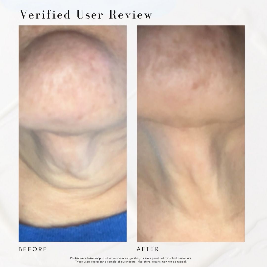 The Advanced Response Complex - Face & Neck Moisture Cream