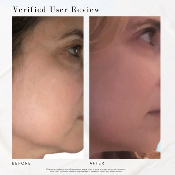 The Advanced Response Complex Face | Neck | Eye Bundle