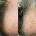 Power Fol *Jumbo* - Advanced Multi-Correctional Scalp & Hair Treatment - Maya Chia Before + After
