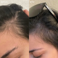 Power Fol Before | After Results