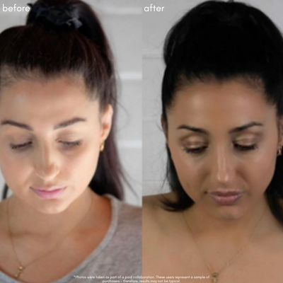 Power Fol  - Advanced Multi-Correctional Scalp & Hair Treatment - Maya Chia Before + After