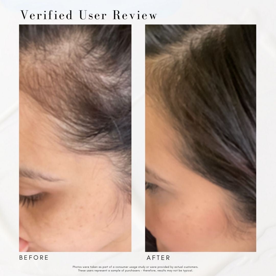 Power Fol™ - Advanced Multi-Correctional Scalp & Hair Treatment