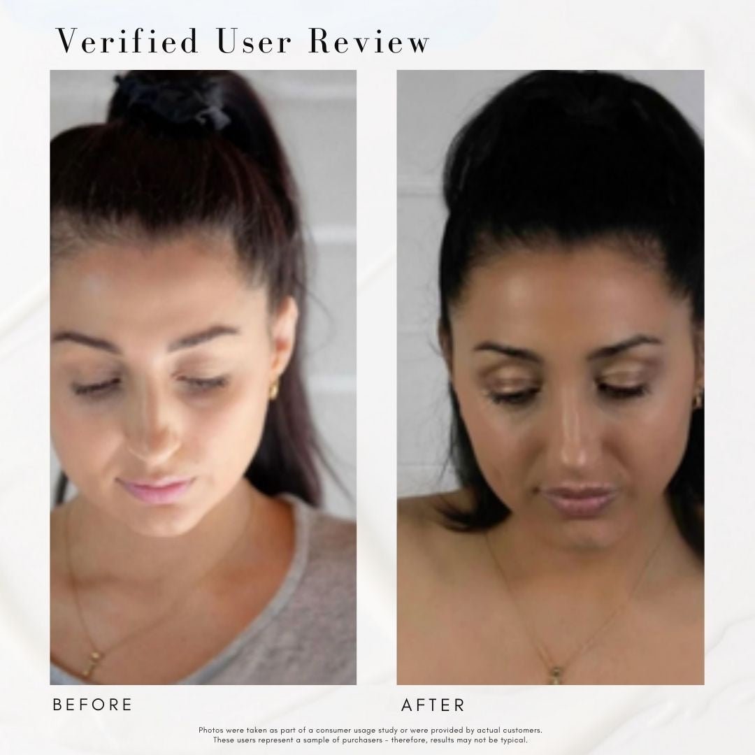 Power Fol™ - Advanced Multi-Correctional Scalp & Hair Treatment