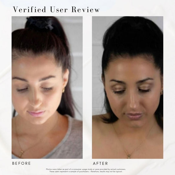 Power fol - advanced multi-correctional scalp & hair treatment