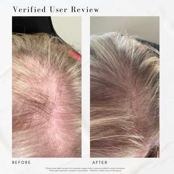 Power Fol™ - Advanced Multi-Correctional Scalp & Hair Treatment