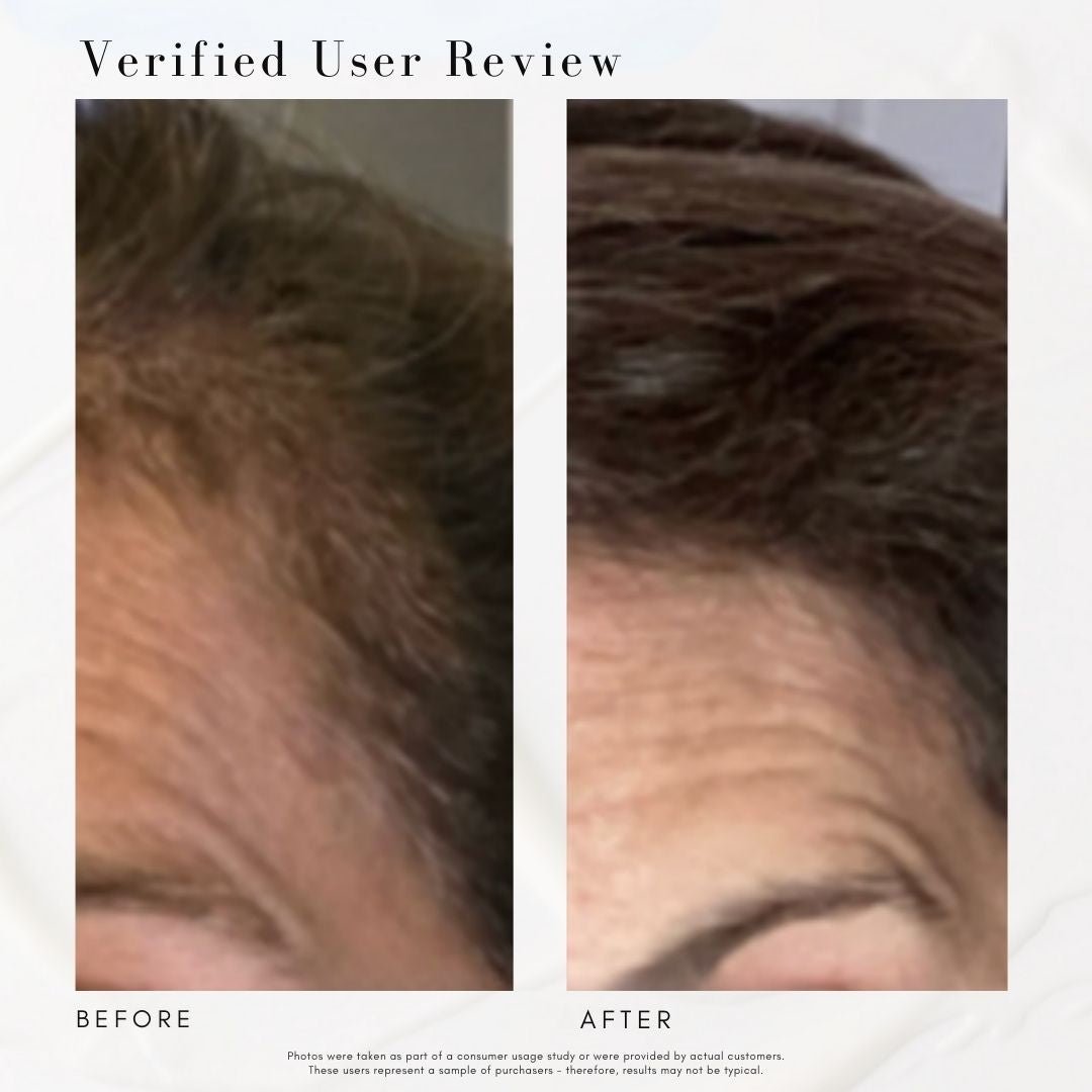 Power Fol™ - Advanced Multi-Correctional Scalp & Hair Treatment