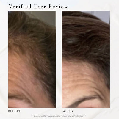 Power Fol™ - Advanced Multi-Correctional Scalp & Hair Treatment