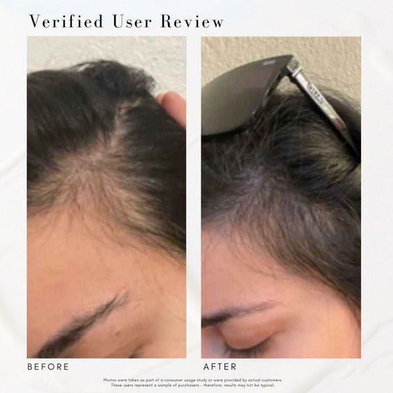 Power Fol™ - Advanced Multi-Correctional Scalp & Hair Treatment