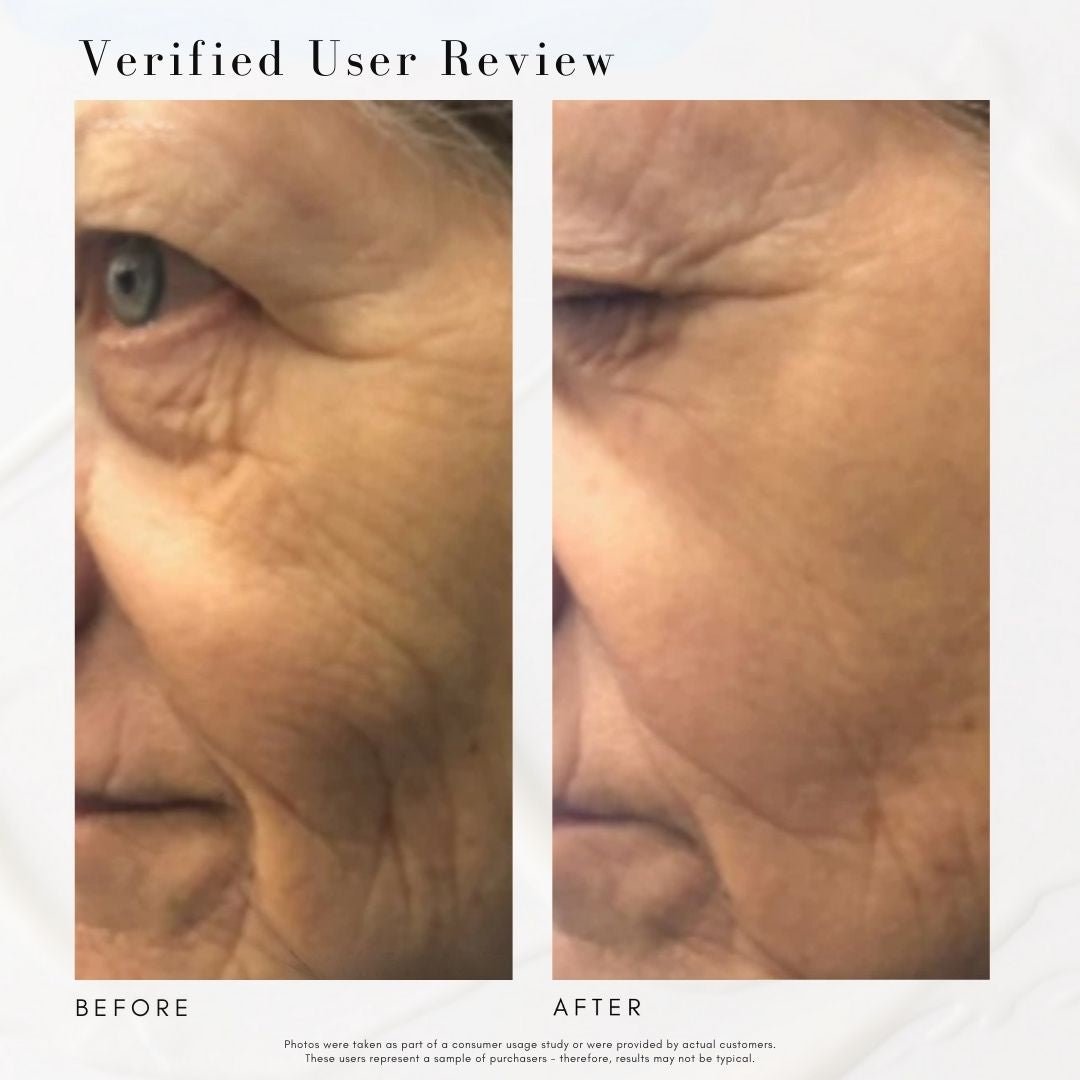 The Super Lift - Concentrated Vitamin C-More treatment