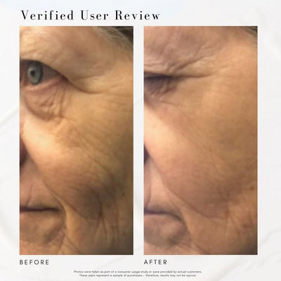 The Super Lift - Concentrated Vitamin C-More treatment