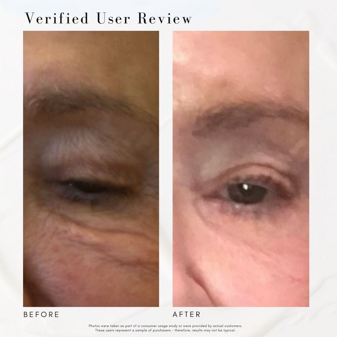 The Super Lift - Concentrated Vitamin C-More treatment