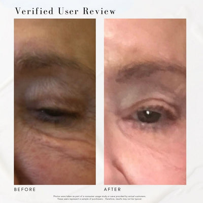 The Super Lift - Concentrated Vitamin C-More treatment