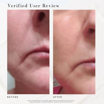 The Super Lift - Concentrated Vitamin C-More treatment