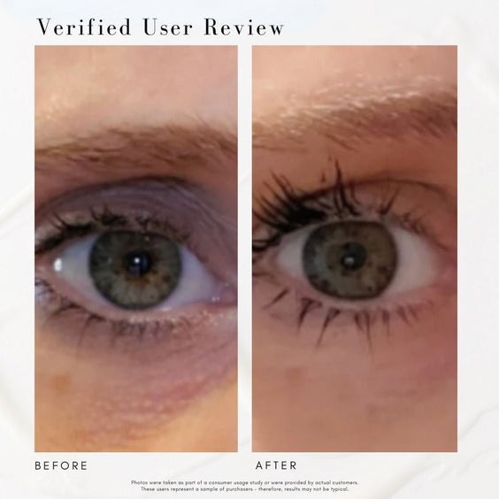 The Super Lift - Concentrated Vitamin C-More treatment