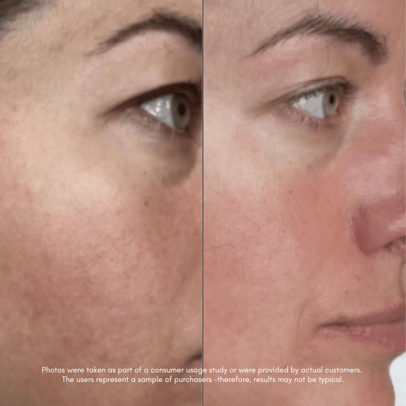 The Great Escape Bundle