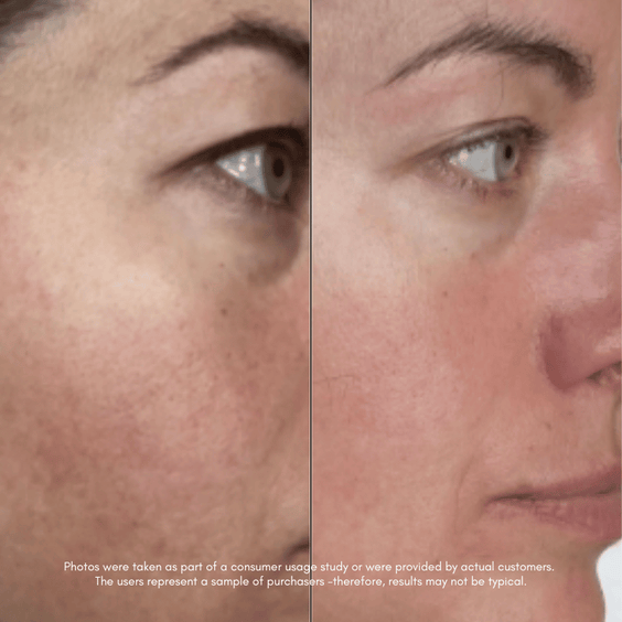 The Great Escape Bundle