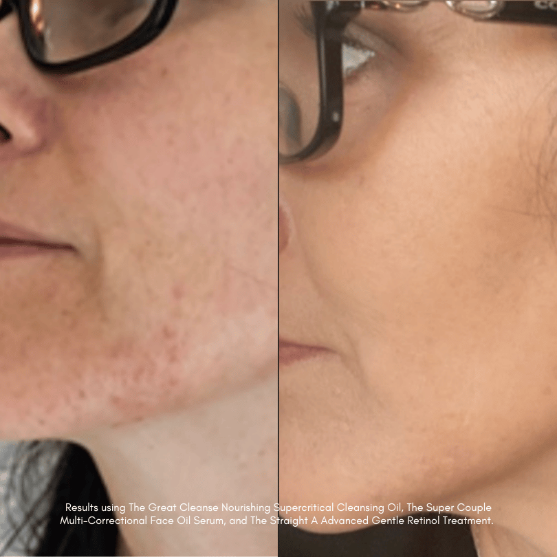 The Great Escape Bundle