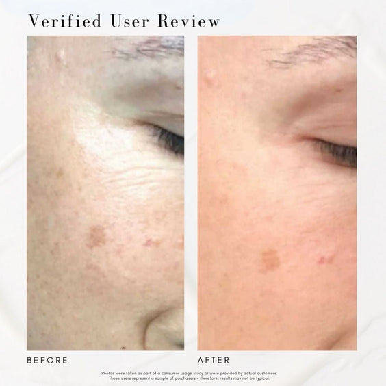 The Skin Refresh Bundle