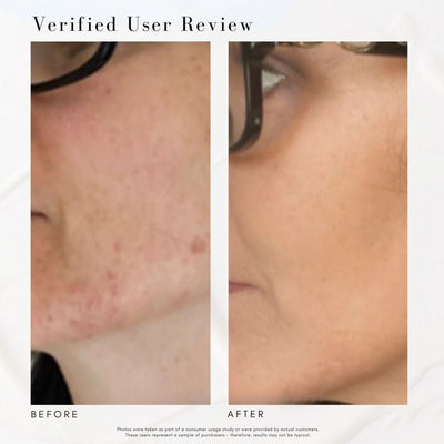 The Skin Refresh Bundle